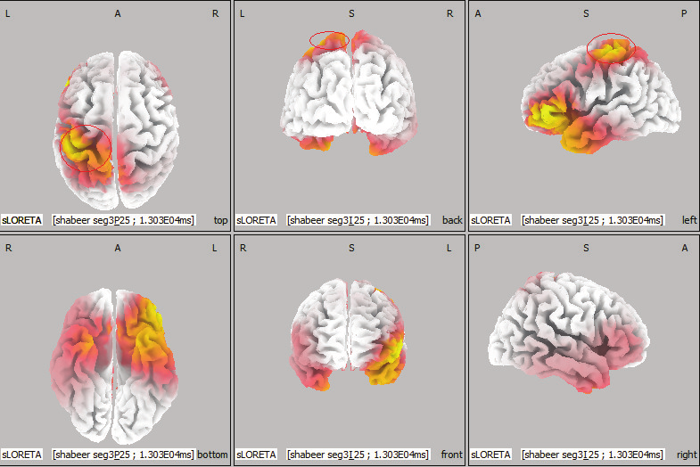Localización de fuentes corticales mediante LORETA a partir de actividad EEG