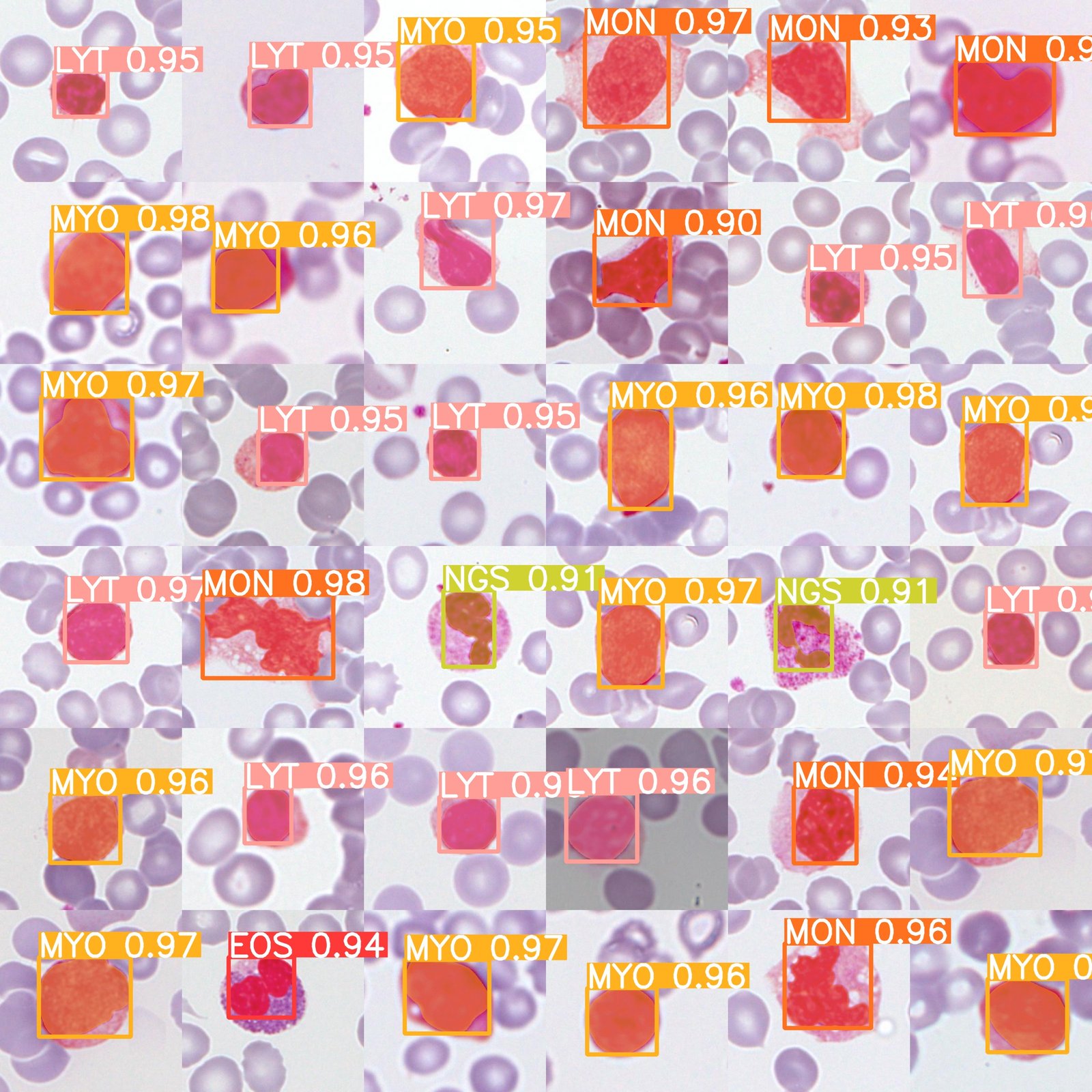 Mosaico de células sanguíneas utilizado en el TFM para detección y clasificación de células de leucemia